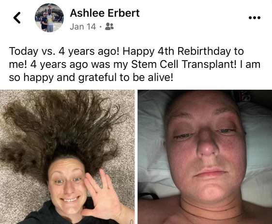 Facebook Screenshot: Ashlee shares a recent photo of herself in remission (holding up Spock's live long and prosper hand gesture) next to a photo of her during treatment.